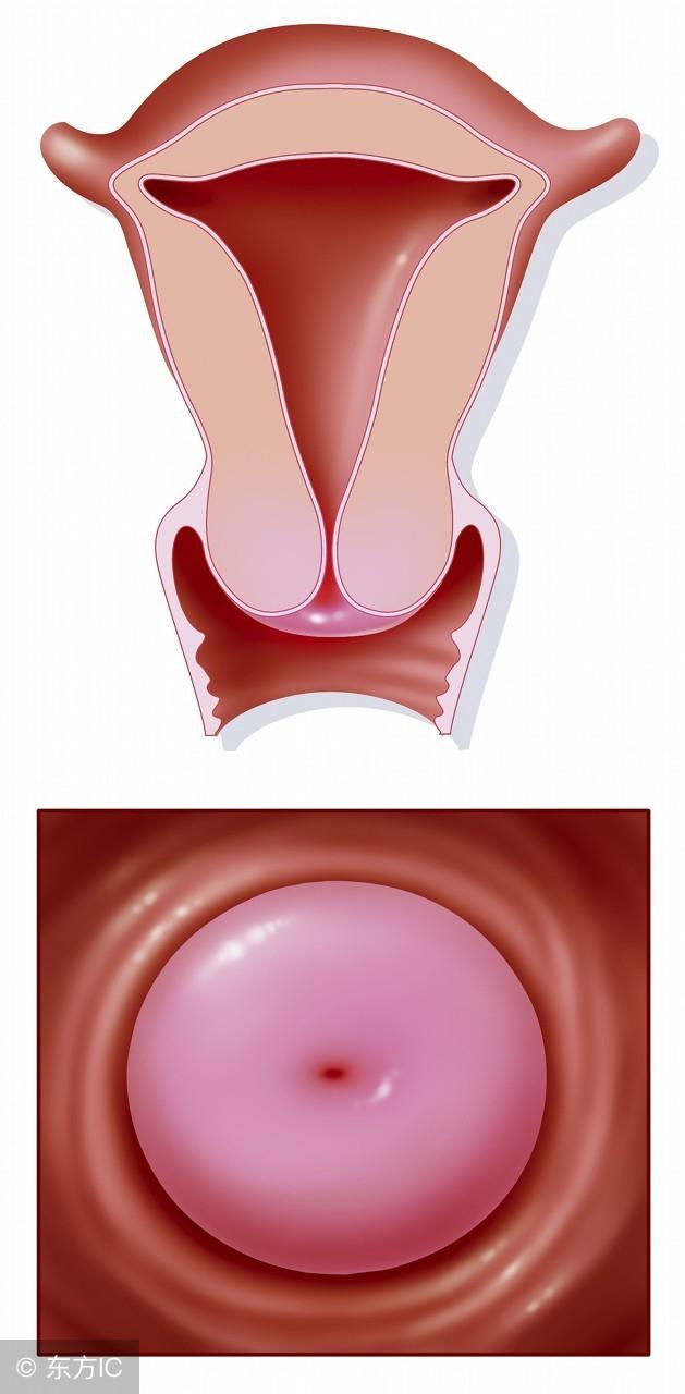 一般表现为宫颈组织充血,女性水肿,上宫宫颈增生等