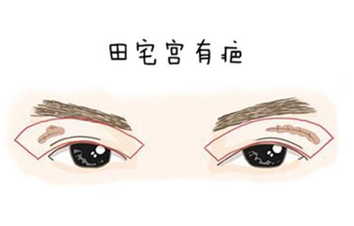 女的破颧纹面相,印堂处发暗,发青-相术-荣耀易学
