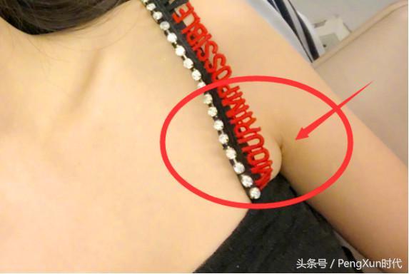 穿吊带裙有副乳怎么办，穿吊带裙有副乳要怎么办好（沈梦辰穿吊带裙被勒出副乳）
