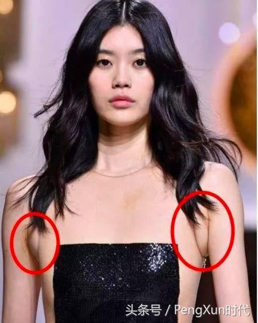 穿吊带裙有副乳怎么办，穿吊带裙有副乳要怎么办好（沈梦辰穿吊带裙被勒出副乳）