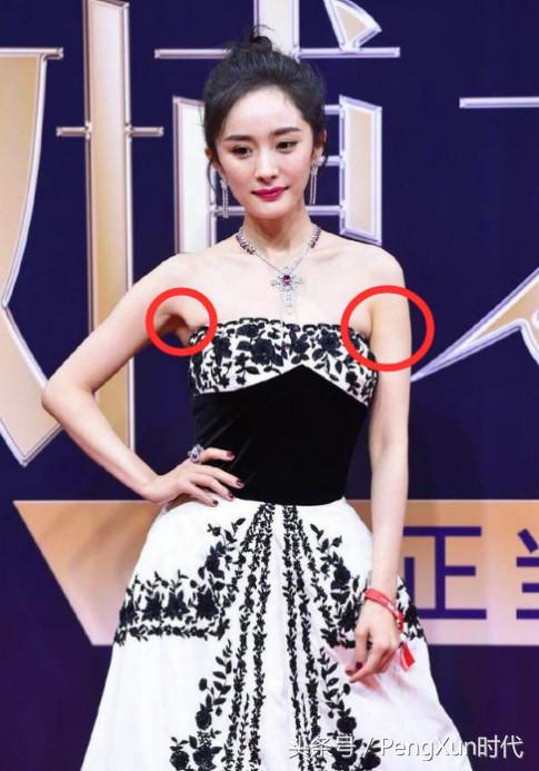 穿吊带裙有副乳怎么办，穿吊带裙有副乳要怎么办好（沈梦辰穿吊带裙被勒出副乳）