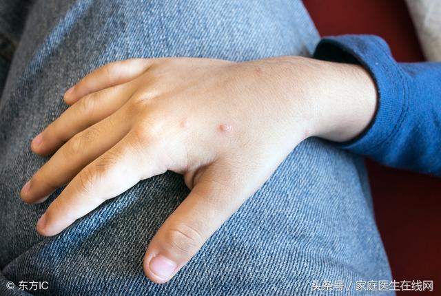 舌苔呈现的颜色分别表征哪些症状,舌苔颜色的诊断意义(舌苔颜色有这一