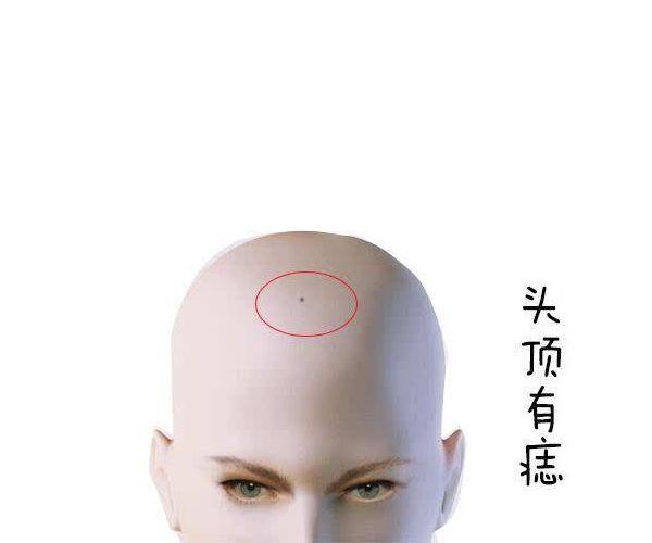 面相学中的四大吉痣，身上有这4种“吉祥痣”的人