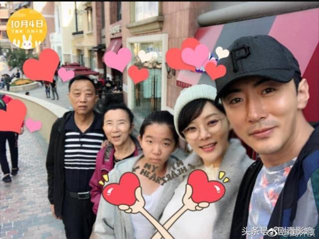 蔡琳整容前后，蔡琳整容了哪里（她因改变一个部位而走红）