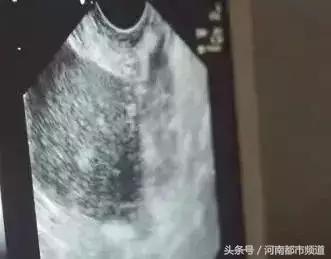 女性卖卵有什么危害，女孩子如何远离卖卵风潮（湖北少女为做这件傻事去卖卵）