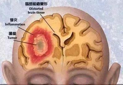 梦见掉下牙齿,医生解梦了!反复做这些梦-解梦-荣耀易学