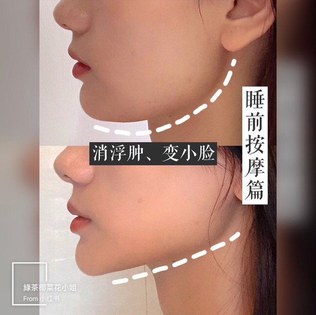 消除双下巴瘦脸的操，脸部按摩操：5步消除双下巴