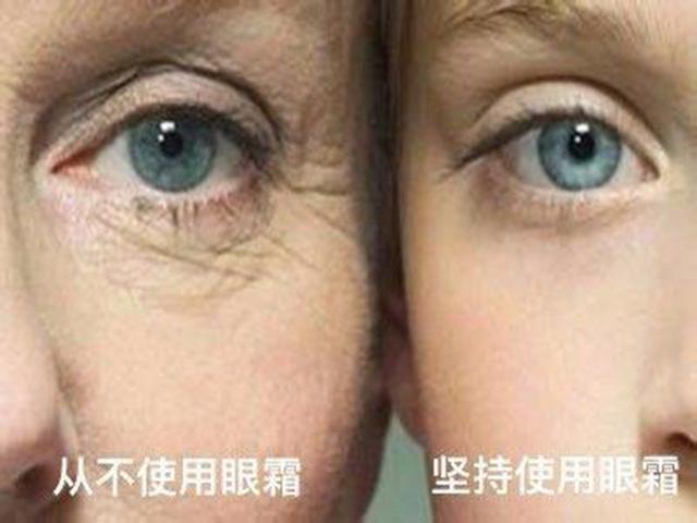 小棕瓶15ml眼霜专柜价，白毒去皱多少钱一针（我就不信你一款都没用过）