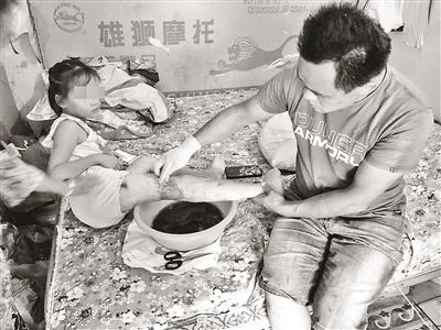 东直门家电维修安装店 女儿烫伤八年未愈 发妻离家出走 父亲求助：想靠自己 多挣钱