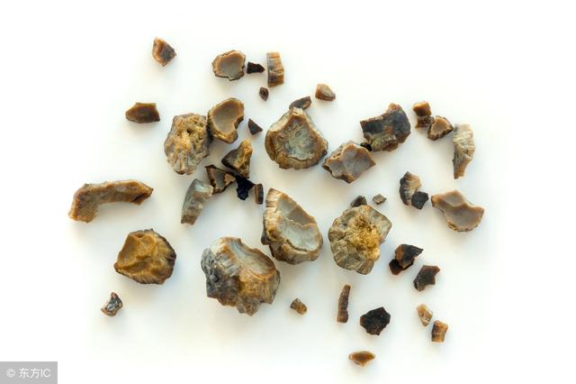 肝结石这个病严重吗,脂肪肝这个病严重吗(可惜很多人都中招了)