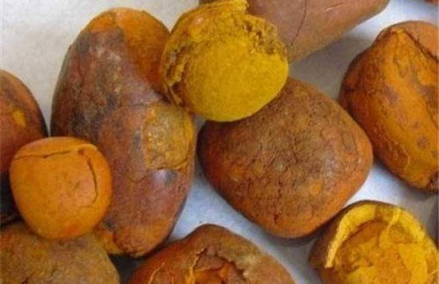 天然牛黄12万元一克，纯天然牛黄3万多一克（农村老人过节杀牛得到一块石头）