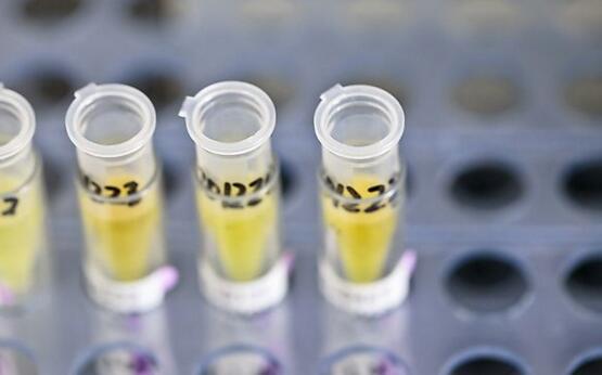 鲜银耳怎么吃防止中毒，超市买的新鲜银耳怎么处理才能吃（告诉你如何挑选银耳更安全）