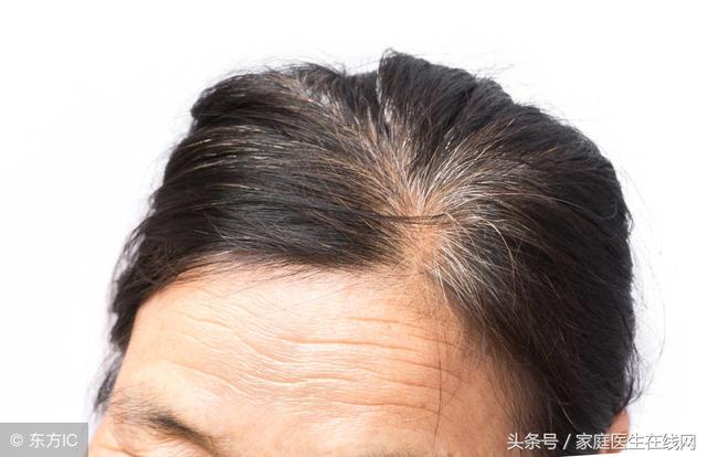 白发变黑发最好的方法，什么偏方治疗白发变黑发（是身体出问题的“警钟”）