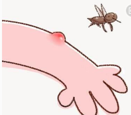 小孩蚊子咬了红肿很大很硬怎么消除，被虫子咬了红肿很硬很大一块（宝宝被蚊子咬并且局部红肿）