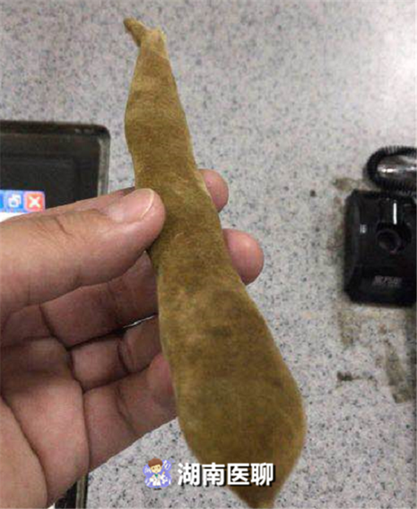 狗儿豆哪种人不能吃，狗可不可以吃豆子（2天前贪吃两颗“狗爪豆”酿大祸）