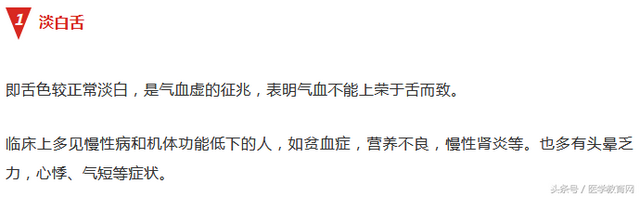 正常人舌头照片，14种舌头的舌象看健康（高血压、糖尿病、支气管炎……这些常见病你的舌头上已经表现出来了）