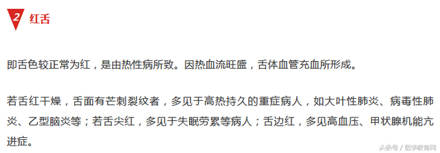 正常人舌头照片，14种舌头的舌象看健康（高血压、糖尿病、支气管炎……这些常见病你的舌头上已经表现出来了）