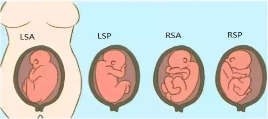 胎位roa是什么意思，产检胎位roa是什么意思（产检单上这3个指标最关键）