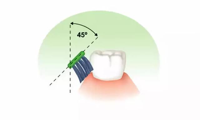 巴氏刷牙法如何操作，巴氏刷牙法7步骤（来学一下巴氏刷牙法<图解>）