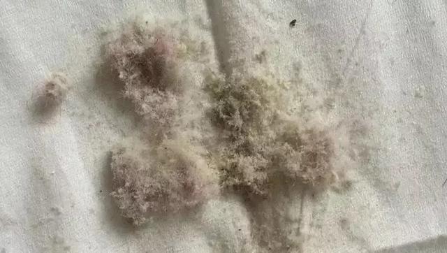 身上有螨虫怎么办，怎么才能清除人身上的螨虫（家庭主妇教你这么做）