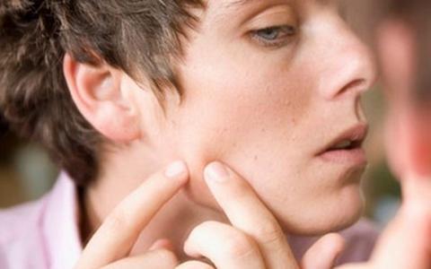 脸上有痘印怎么办，小宝宝脸上有痘印怎么办（医生教你最好使的解决办法）