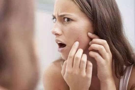 脸上有痘印怎么办，小宝宝脸上有痘印怎么办（医生教你最好使的解决办法）