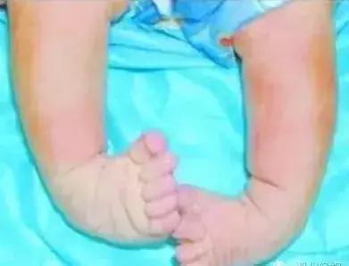 为什么国家禁止用学步车,为什么不建议用学步车(加拿大已经立法禁止这个“育儿神器”) 为什么国家禁止用学步车,为什么不建议用学步车(加拿大已经立法禁止这个“育儿神器”)