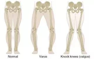 为什么国家禁止用学步车,为什么不建议用学步车(加拿大已经立法禁止这个“育儿神器”) 为什么国家禁止用学步车,为什么不建议用学步车(加拿大已经立法禁止这个“育儿神器”)