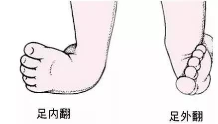 为什么国家禁止用学步车,为什么不建议用学步车(加拿大已经立法禁止这个“育儿神器”) 为什么国家禁止用学步车,为什么不建议用学步车(加拿大已经立法禁止这个“育儿神器”)