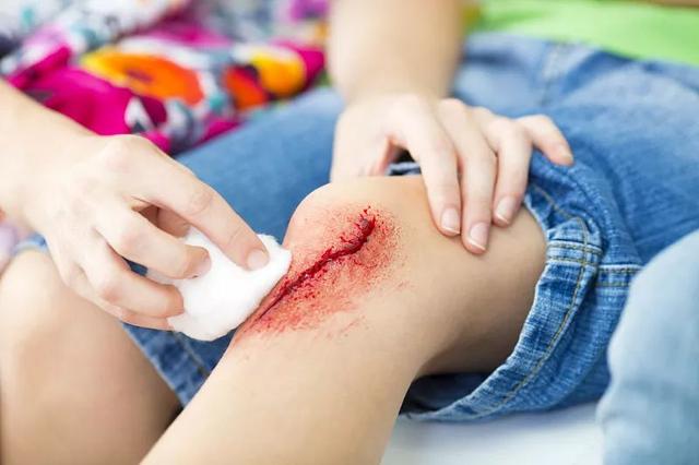 碘伏的作用和使用方法，碘伏的作用使用方法及注意事项（酒精、碘伏、紫药水……到底怎么用）