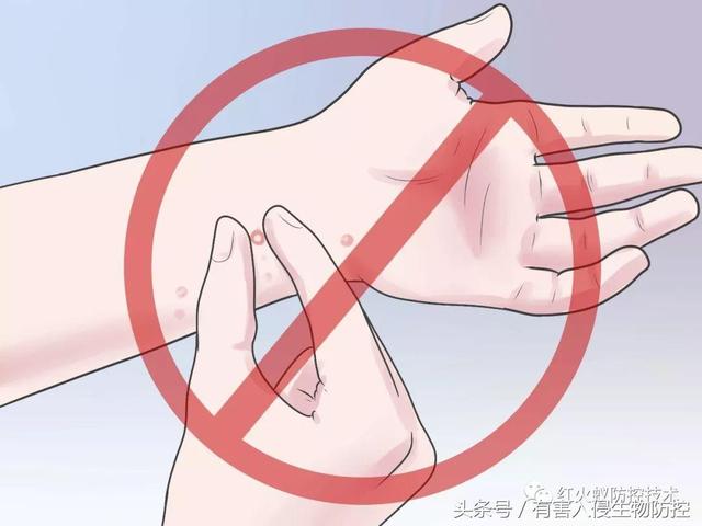 火蚁咬伤红肿怎么办，红火蚁咬伤后如何消肿（正确的处理方法是这样）