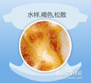 大便颜色健康对照表，大便正常颜色（婴儿12种大便颜色性状）