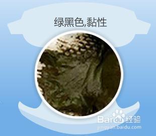 大便颜色健康对照表，大便正常颜色（婴儿12种大便颜色性状）