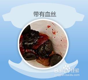 大便颜色健康对照表，大便正常颜色（婴儿12种大便颜色性状）