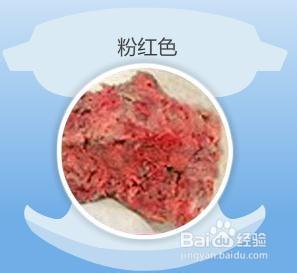 大便颜色健康对照表，大便正常颜色（婴儿12种大便颜色性状）