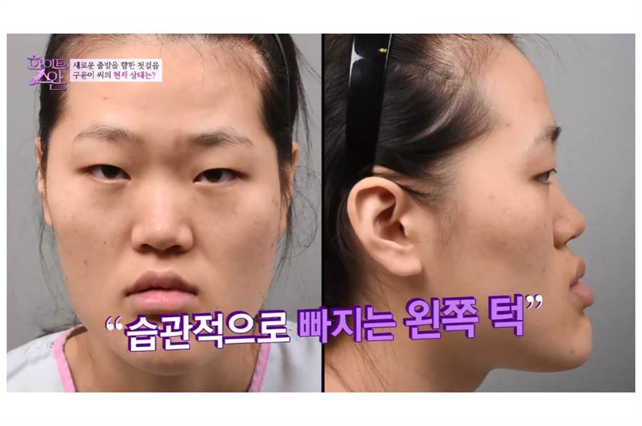 韩国「整形版」丑女大翻身网友:这是同一个人吗?