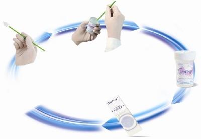 tbs是什么意思，tbs和tct有什么区别（HPV和TCT的报告单怎么看）