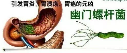 胃炎吃什么药，胃炎吃什么药管事（胃炎患者想知道的用药问题）