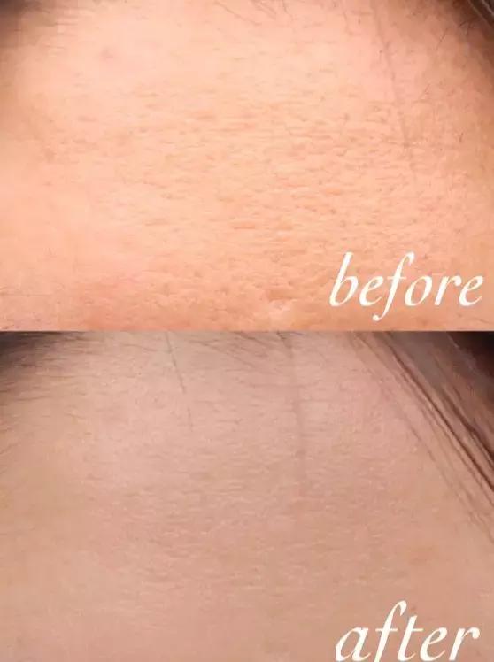 安瓶是什么,化妆品安瓶是什么(安瓶到底是个什么神仙护肤品) 安瓶是什么,化妆品安瓶是什么(安瓶到底是个什么神仙护肤品)