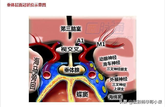 颅脑mri(头部MRI)插图(17)