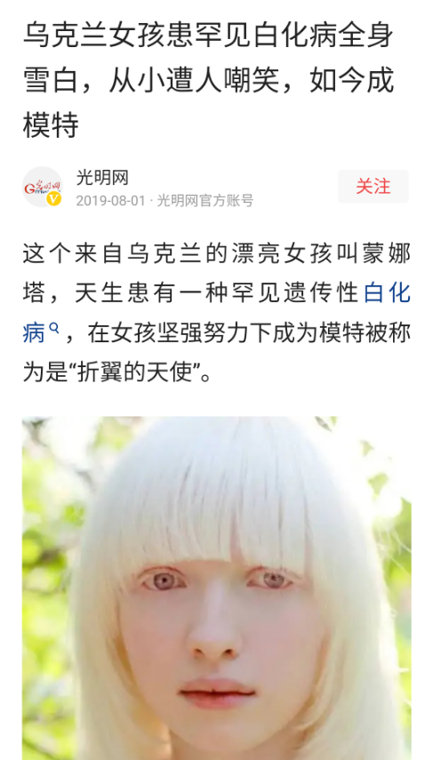 白化病是遗传病吗，白化病是什么（被误解的白化病：会传染）