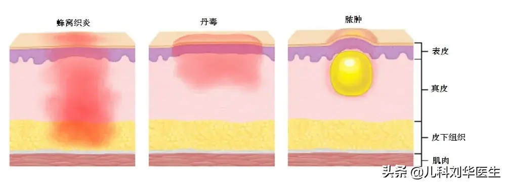 讳疾忌医的主人公是谁，这个典故中的君王是谁（读“讳疾忌医”这么多年）