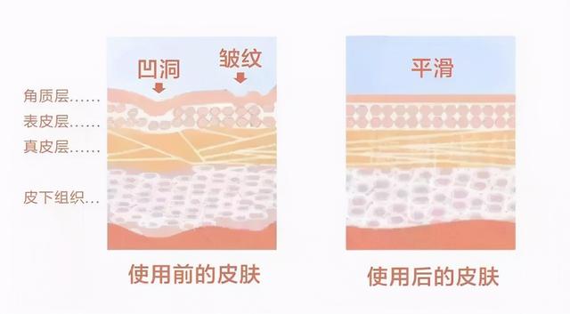 寡肽是什么，14种呱太获得攻略介绍（有效祛痘修护还是智商税呢）