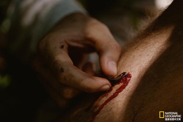 什么是寄生虫，寄生虫怎么治疗（寄生虫一定有害吗）