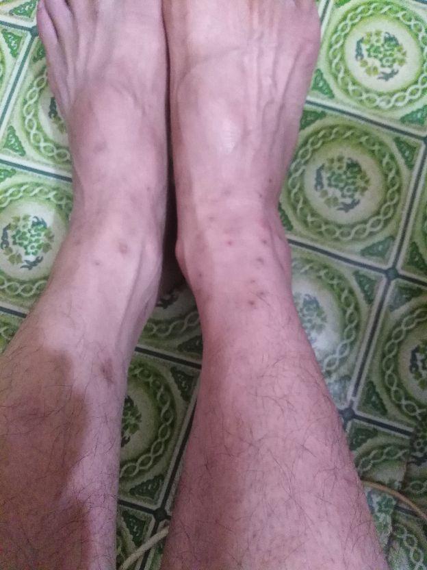 红火蚁怎么消灭，红火蚁的防治方法（一锅端消灭红火蚁配方）