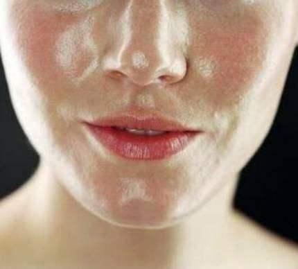 芦荟祛痘方法是什么，芦荟祛痘方法是什么意思（教你3个祛痘植物配方）