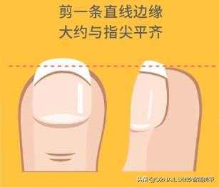 晚上可以剪指甲吗，晚上可以剪手指甲和脚趾甲吗（原来晚上不可以剪指甲的原因是这个）