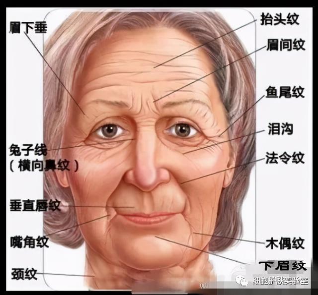 泥奏凯是什么意思，皱纹小百科-泪沟，泥奏凯