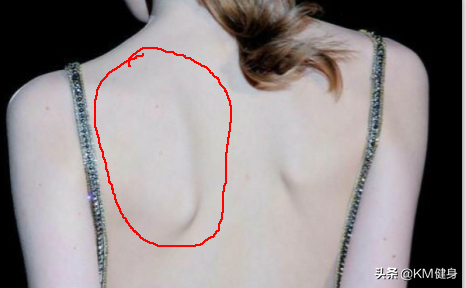 肩胛骨突出，肩胛骨突出图片（4个动作帮你改善）