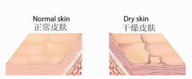 皮肤美白小窍门，皮肤美白小窍门是什么（改善肤色暗沉的4个小技巧）